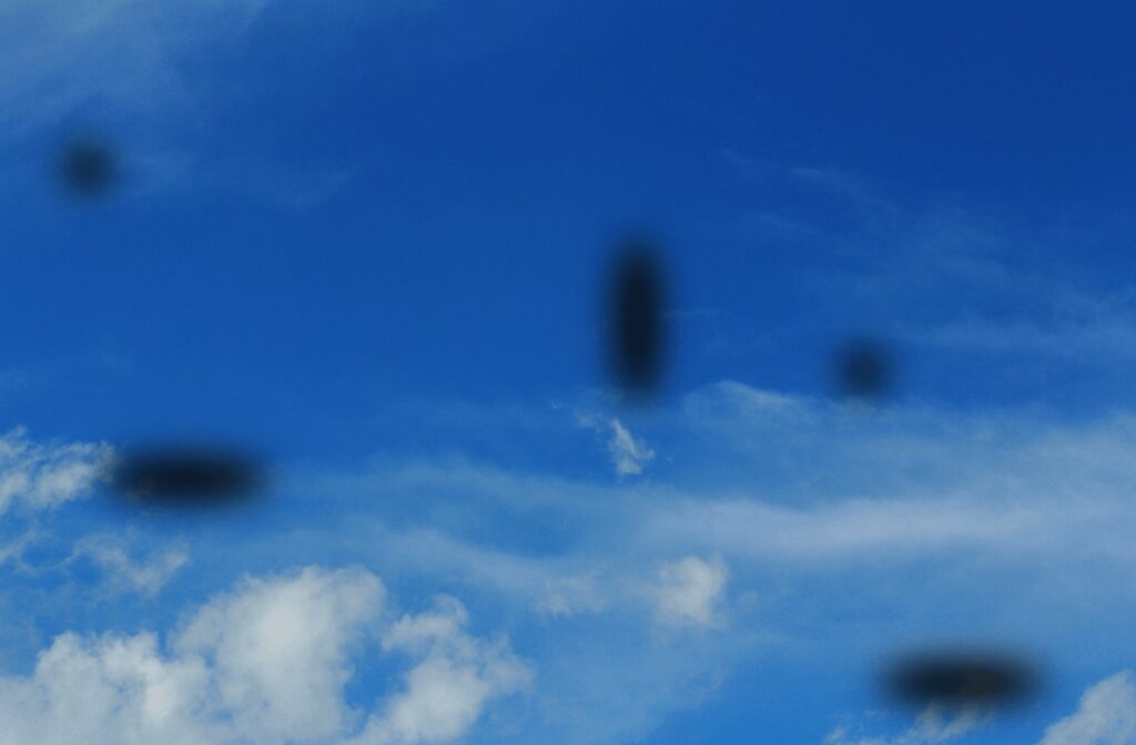 The point of view of someone who has eye floaters looking at a blue sky with clouds