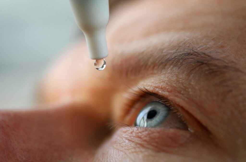 A man carefully applying eye drops to his left eye to find relief from his dry eyes.