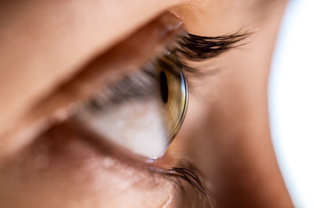 A close-up side view of a person's eye and cornea.